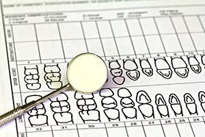 Dental Chart